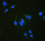 IF/ICC staining of FFPE human U-2 OS cells with ALDH7A1 antibody (green) at 2ug/ml and DAPI nuclear stain (blue). HIER: steam section in pH6 citrate buffer for 20 min.