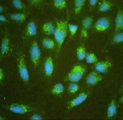IF/ICC staining of FFPE human U-2 OS cells with ALDH7A1 antibody (green) at 2ug/ml and DAPI nuclear stain (blue). HIER: steam section in pH6 citrate buffer for 20 min.
