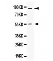 Western blot testing of human HeLa lysate with APC2 antibody at 0.5ug/ml. N-terminal APC2 antibodies generally show three bands above 200 kDa and may show three degradation or splice variant forms at ~121, 81 and 51 kDa (Ref. 1).