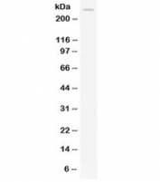 Western blot testing of human HeLa lysate with APOB antibody at 0.5ug/ml. Predicted molecular weight: ~516 kDa (ApoB-100), ~240 kDa (ApoB-48).