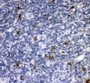 IHC staining of FFPE human tonsil tissue with Cathepsin G antibody. HIER: boil tissue sections in pH8 EDTA for 20 min and allow to cool before testing.