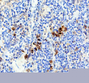 IHC staining of FFPE rat spleen tissue with Neutrophil Elastase antibody, HRP-labeled secondary and DAB substrate. HIER: boil tissue sections in pH8 EDTA buffer for 20 min and allow to cool before testing.