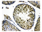 IHC staining of FFPE mouse testis tissue with KDM5B antibody. HIER: boil tissue sections in pH8 EDTA for 20 min and allow to cool before testing.