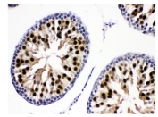 IHC staining of FFPE rat testis tissue with KDM5B antibody. HIER: boil tissue sections in pH8 EDTA for 20 min and allow to cool before testing.
