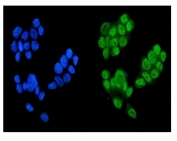Immunofluorescent staining of FFPE human MCF7 cells with KDM5B antibody (green) and DAPI nuclear stain (blue). HIER: steam section in pH6 citrate buffer for 20 min.