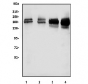 Western blot testing of 1) monkey COS-7, 2) human SH-SY5Y, 3) rat testis and 4) mouse testis tissue lysate with KDM5B antibody at 0.5ug/ml. Predicted molecular weight: ~176 kDa and ~179 kDa (two isoforms).