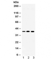 Western blot testing of 1) rat spleen, 2) mouse ANA-1 and 3) human Jurkat lysate with LDHA antibody at 0.5ug/ml.  Predicted/observed molecular weight ~36 kDa.
