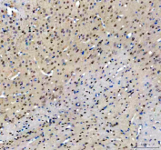 IHC staining of FFPE rat brain tissue with NFIA antibody, HRP-secondary and DAB substrate. HIER: boil tissue sections in pH8 EDTA for 20 min and allow to cool before testing.