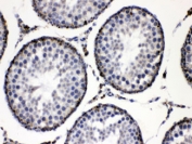 IHC testing of FFPE rat testis with ADRP antibody at 1ug/ml.  HIER: steam section in pH6 citrate buffer for 20 min.
