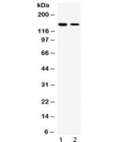 Western blot testing of human 1) HeLa and 2) MCF7 cell lysate with SAFB antibody at 0.5ug/ml. Predicted molecular weight: ~103 kDa but routinely observed at ~150 kDa, consistent with the phosphorylated and structurally disordered nature of the SAFB protein that causes slower migration on SDS-PAGE.