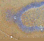 IHC staining of FFPE rat brain tissue with Synapsin II antibody, HRP-secondary and DAB substrate. HIER: boil tissue sections in pH8 EDTA for 20 min and allow to cool before testing.