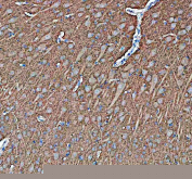 IHC staining of FFPE pig brain tissue with Synapsin II antibody, HRP-secondary and DAB substrate. HIER: boil tissue sections in pH8 EDTA for 20 min and allow to cool before testing.