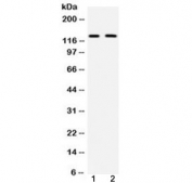 Western blot testing of mouse 1) brain and 2) HEPA lysate with mouse CD11b antibody at 0.5ug/ml. Expected molecular weight: 127~170 kDa due to glycosylation.