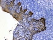 IHC testing of FFPE human tonsil tissue with Cytokeratin 5 antibody at 1ug/ml. HIER: steam section in pH6 citrate buffer for 20 min.