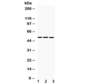 Western blot testing of 1) rat liver, 2) mouse liver and 3) human HepG2 lysate with Fibrinogen gamma chain antibody at 0.5ug/ml. Predicted molecular weight ~50 kDa.