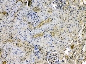 IHC testing of FFPE rat kidney tissue with Purine nucleoside phosphorylase antibody at 1ug/ml. HIER: steam section in pH6 citrate buffer for 20 min.