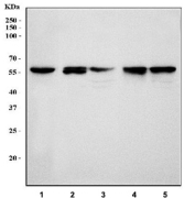 Western blot testing of 1) human HepG2, 2) rat kidney, 3) rat liver, 4) mouse kidney and 5) mouse liver tissue lysate with Fibrinogen beta chain antibody at 0.5ug/ml. Predicted molecular weight ~56 kDa.