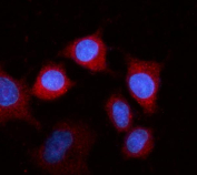 Immunofluorescent staining of FFPE human A549 cells with Fibrinogen beta chain antibody (red) and DAPI nuclear stain (blue). HIER: steam section in pH6 citrate buffer for 20 min.