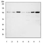 Western blot testing of 1) human HeLa, 2) human MCF7, 3) human HepG2, 4) rat skeletal muscle, 5) rat heart, 6) mouse skeletal muscle and 7) mouse heart tissue lysate with Hexokinase II antibody at 0.5ug/ml.  Predicted molecular weight ~102 kDa.