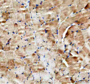 IHC staining of FFPE mouse skeletal muscle tissue with Hexokinase II antibody. HIER: boil tissue sections in pH8 EDTA for 20 min and allow to cool before testing.