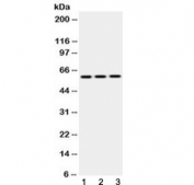 Western blot testing of 1) rat brain, 2) mouse NIH3T3 and 3) human HepG2 lysate with Cytokeratin 14 antibody at 0.5ug/ml. Predicted molecular weight ~53 kDa.