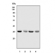 Western blot testing of human 1) HepG2, 2) Daudi, 3) MOLT4 and 4) HL60 cell lysate with hnRNP A1 antibody. Expected molecular weight: 29-39 kDa (multiple isoforms).
