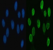 Immunofluorescent staining of FFPE human MCF7 cells with hnRNP L antibody (green) and DAPI nuclear stain (blue). HIER: steam section in pH6 citrate buffer for 20 min.