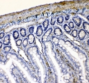 IHC staining of FFPE rat intestine tissue with VASP antibody. HIER: boil tissue sections in pH8 EDTA for 20 min and allow to cool before testing.