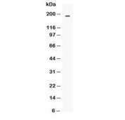 Western blot testing of human COLO320 cell lysate with MRP4 antibody at 0.5ug/ml. Predicted molecular weight ~150 kDa, often observed at 170-200 kDa.
