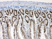 IHC testing of FFPE rat intestine tissue with Musashi antibody at 1ug/ml. Required HIER: steam section in pH6 citrate buffer for 20 min and allow to cool prior to testing.
