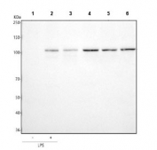 Western blot testing of human 1) ThP-1 without LPS treatment, 2) ThP-1 with LPS treatment, 3) HaCaT, 4) PC-3, 5) Caco-2 and 6) HepG2 cell lysate with TLR2 antibody. Predicted molecular weight: 85-90 kDa.