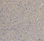 IHC testing of FFPE rat brain tissue with CD90 antibody. Required HIER: steam section in pH8 EDTA for 20 min and allow to cool prior to testing.