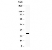 Western blot testing of mouse thymus tissue with TNF alpha antibody at 0.5ug/ml. Predicted molecular weight ~26 kDa.