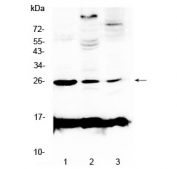 Western blot testing of rat 1) spleen, 2) brain and 3) thymus tissue with Crp antibody at 0.5ug/ml. Predicted molecular weight ~25 kDa.