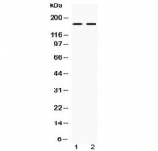 Western blot testing of 1) rat brain and 2) mouse brain lysate with NOS1 antibody at 0.5ug/ml. Predicted molecular weight ~160 kDa.