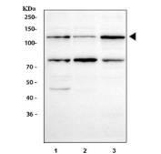 Western blot testing of human 1) HeLa, 2) Caco-2 and 3) SH-SY5Y cell lysate with iNOS antibody at 0.5ug/ml. Predicted molecular weight ~130 kDa.