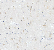 IHC staining of FFPE human brain tissue with iNOS antibody, HRP-secondary and DAB substrate. HIER: boil tissue sections in pH8 EDTA for 20 min and allow to cool before testing.