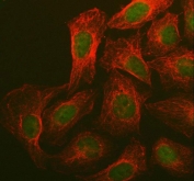 Immunofluorescent staining of FFPE human U-2 OS cells with BRCA1 antibody (green) and Beta Tubulin mAb (red). HIER: steam section in pH6 citrate buffer for 20 min.
