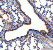 IHC staining of FFPE rat lung tissue with ALDH1A3 antibody, HRP-secondary and DAB substrate. HIER: boil tissue sections in pH8 EDTA for 20 min and allow to cool before testing.