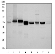 Western blot testing of 1) human HepG2, 2) human U-87 MG, 3) human PC-3, 4) rat liver, 5) rat kidney, 6) rat C6, 7) mouse liver and 8) mouse kidney tissue lysate with ALDH1A3 antibody at 0.5ug/ml. Predicted molecular weight ~56 kDa.