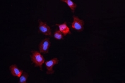 Immunofluorescent staining of human A431 cells with ALDH1A3 antibody (red) and DAPI nuclear stain (blue).