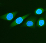 Immunofluorescent staining of FFPE human SiHa cells with ALDH1A3 antibody (green) and DAPI nuclear stain (blue). HIER: steam section in pH6 citrate buffer for 20 min.
