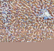 IHC staining of FFPE human liver tissue with ALDH1A3 antibody, HRP-secondary and DAB substrate. HIER: boil tissue sections in pH8 EDTA for 20 min and allow to cool before testing.