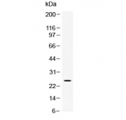 Western blot testing of rat kidney lysate with Vegf antibody at 0.5ug/ml. Expected molecular weight 19~22 kDa (monomer) and 38~44 kDa (dimer). Banding may appear larger than predicted due to glycosylation.