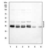 Western blot testing of 1) human MCF7, 2) human U-251, 3) human HeLa, 4) human K562, 5) rat brain and 6) mouse brain tissue lysate with MC2R antibody at 0.5ug/ml. Predicted molecular weight: ~33-43 kDa depending on level of glycosylation.