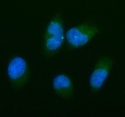 Immunofluorescent staining of FFPE human TPC-1 cells with Bcl-XL antibody (green) and DAPI nuclear stain (blue). HIER: steam section in pH6 citrate buffer for 20 min.