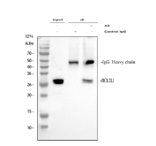 Immunoprecipitation of Bcl-XL protein from 500ug of human A549 whole cell lysate with 2ug of Bcl-XL antibody.