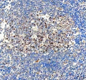 IHC staining of FFPE human tonsil tissue with BAG1 antibody. HIER: boil tissue sections in pH8 EDTA for 20 min and allow to cool before testing.