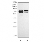 Western blot testing of human 1) placenta and 2) HCCT cell lysate with ANGPTL4 antibody. Predicted molecular weight: ~45 kDa and ~41 kDa, but may be observed at higher molecular weights due to glycosylation.