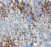 IHC staining of FFPE human spleen tissue with ANGPTL4 antibody. HIER: boil tissue sections in pH8 EDTA for 20 min and allow to cool before testing.